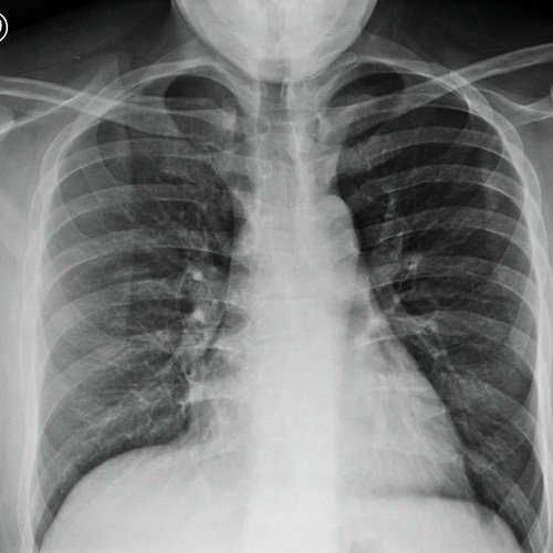Varón de 34 años con palidez, ictericia y palpitaciones