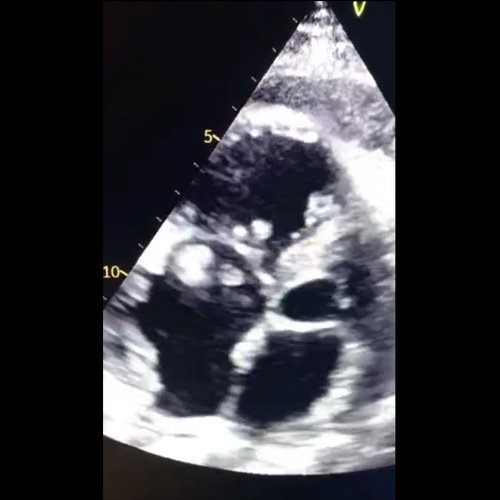 Anexo 3: Ecocardiograma transtorácico DÍA 9