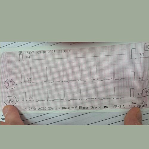 Electrocardiograma Dia 12