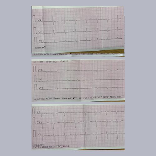 Electrocardiograma C: Dia 4