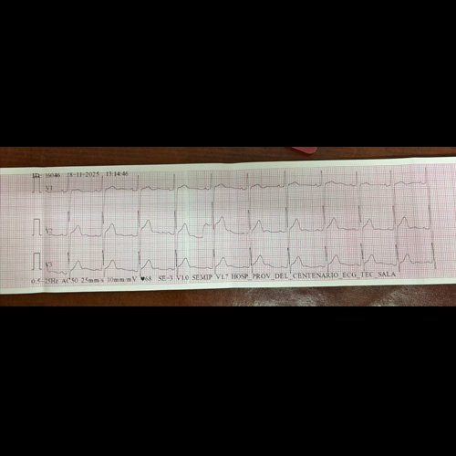  Electrocardiograma Día 1
