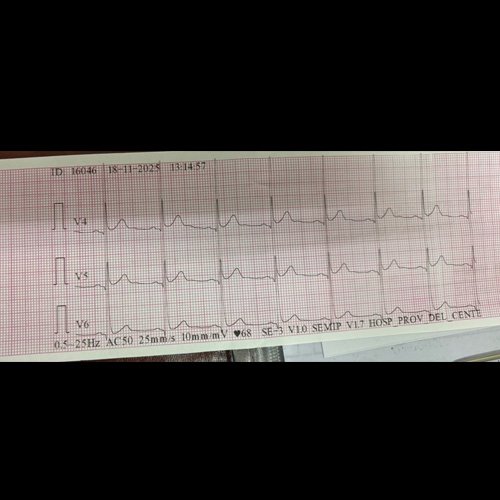  Electrocardiograma Día 1