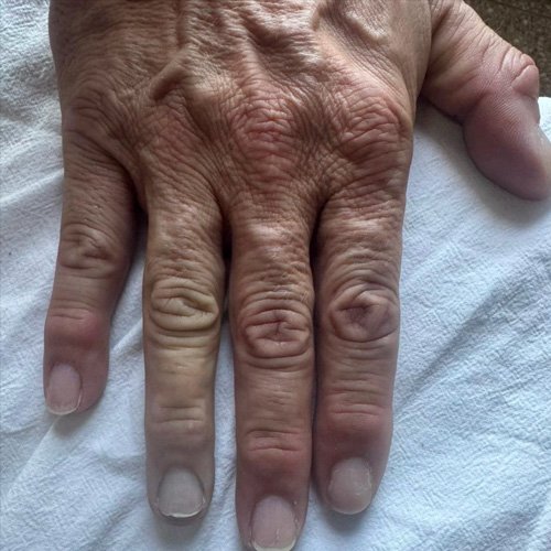 Fotografías de dedo anular derecho 