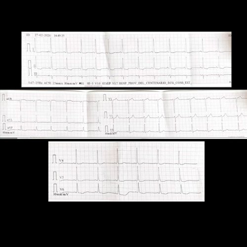 Electrocardiograma 12 derivaciones (al ingreso, 26/02/2026)