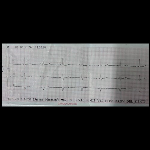 Electrocardiograma Día 4
