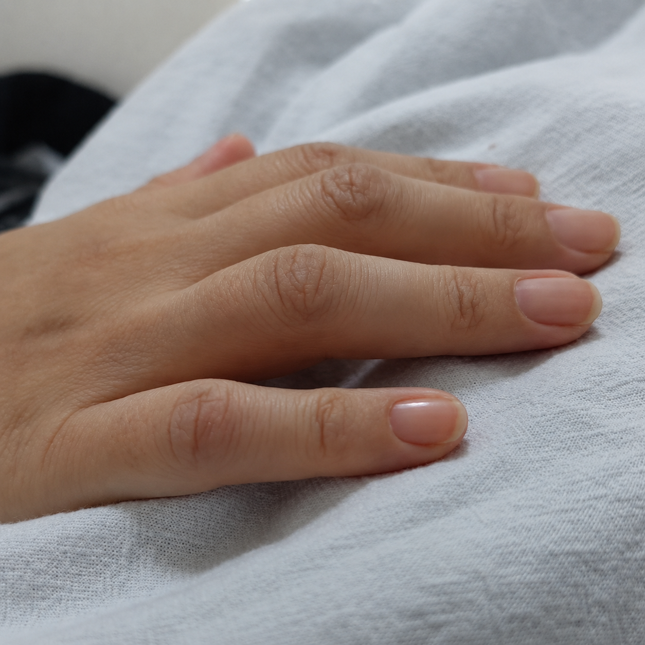 Sindrome febril en estudio: el rostro incierto de la autoinmunidad